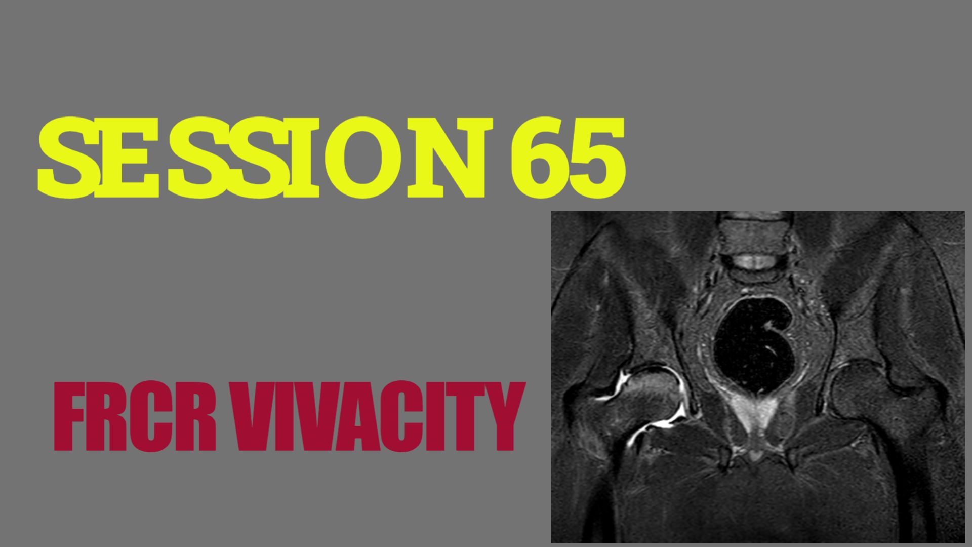 blue background simple title on the side thumbnail design